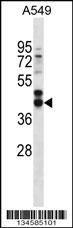 FST Antibody