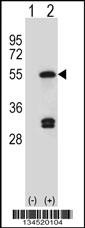 FDFT1 Antibody