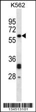 NMT2 Antibody