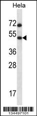 HSFX1 Antibody
