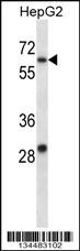 KCNC1 Antibody