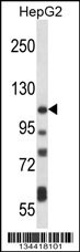 ATP2B4 Antibody