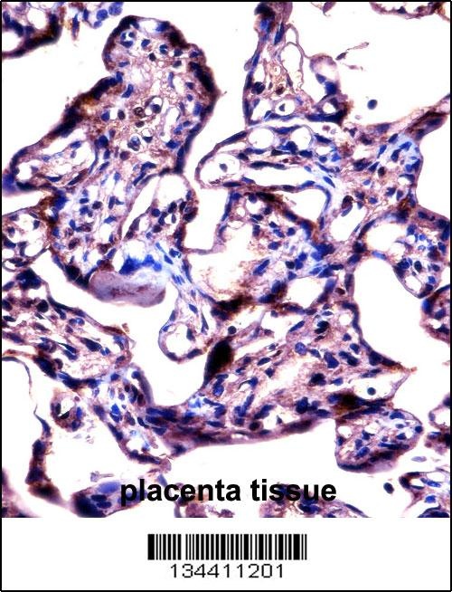 STS Antibody
