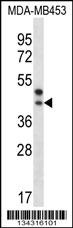 PPT2 Antibody