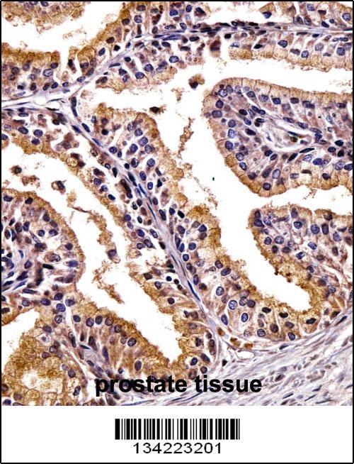 PHLDA2 Antibody