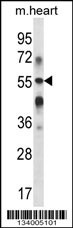 B3GALT2 Antibody