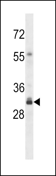 OR4F3 Antibody