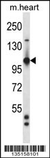 Tie1 Antibody