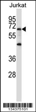 PRDM6 Antibody