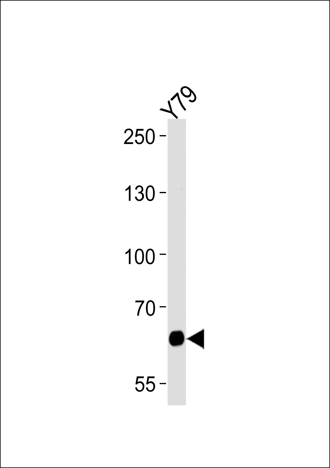 PPEF2 Antibody