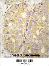 POTED Antibody