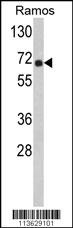 POTED Antibody