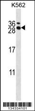 RCAN3 Antibody