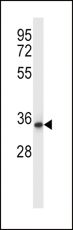 QPRT Antibody