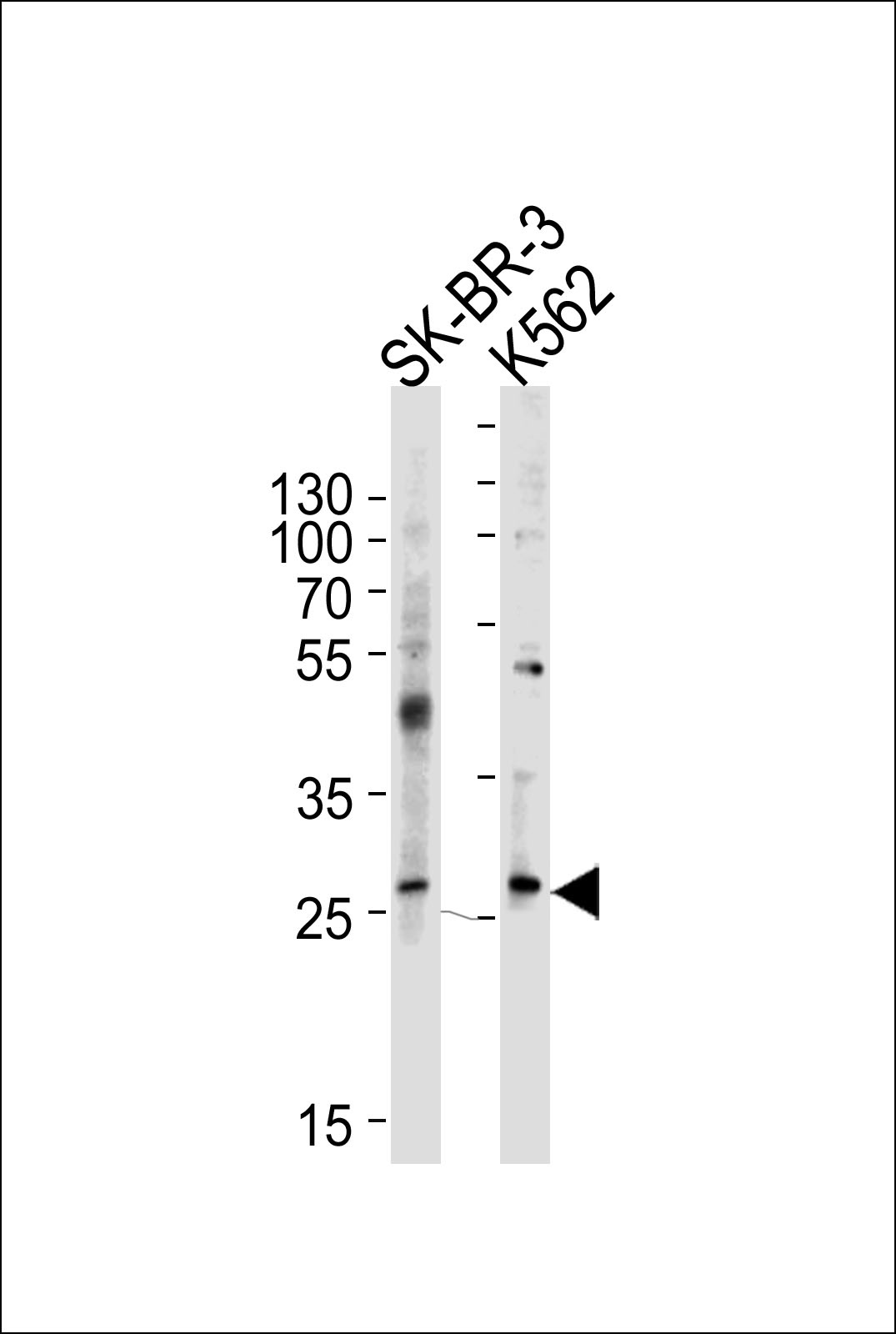 FRAT1 Antibody