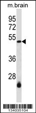 SMARCB1 Antibody