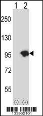 USP15 Antibody