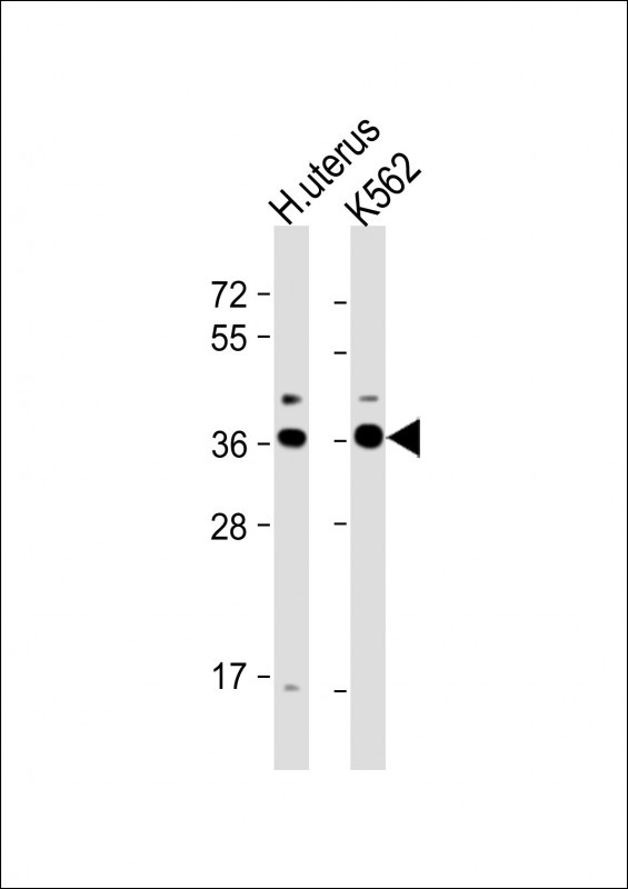 OR52H1 Antibody