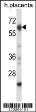Mouse Nrbp2 Antibody