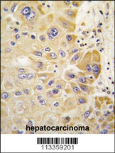 ALDH2 Antibody