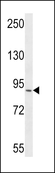RRP1B Antibody