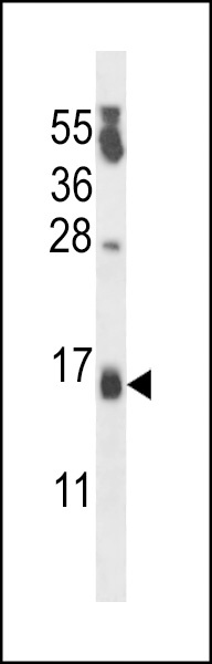 CSDC2 Antibody