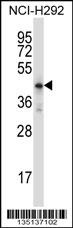 Mouse Hoxd10 Antibody