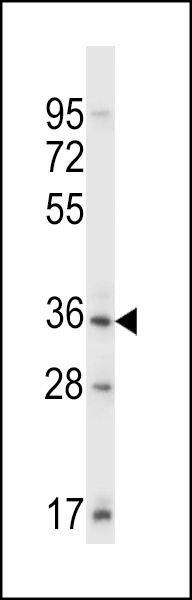 Mouse Sgk110 Antibody