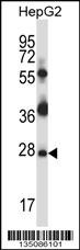 Mouse Tp53rk Antibody