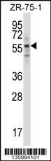 Rps6kb1 Antibody