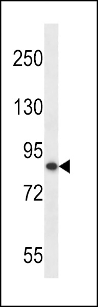 OTUD7B Antibody