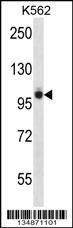 Ptk2b Antibody
