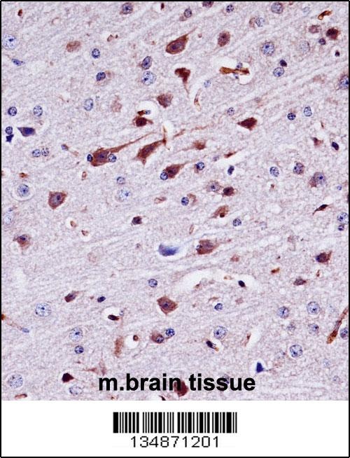 Ptk2b Antibody