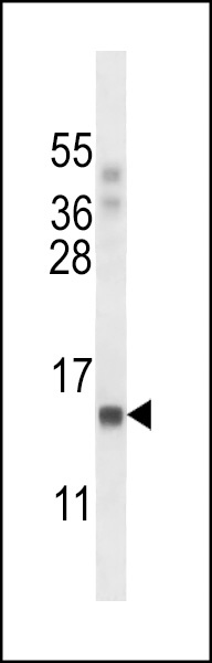 POLR2J Antibody