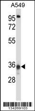 CCDC50 Antibody