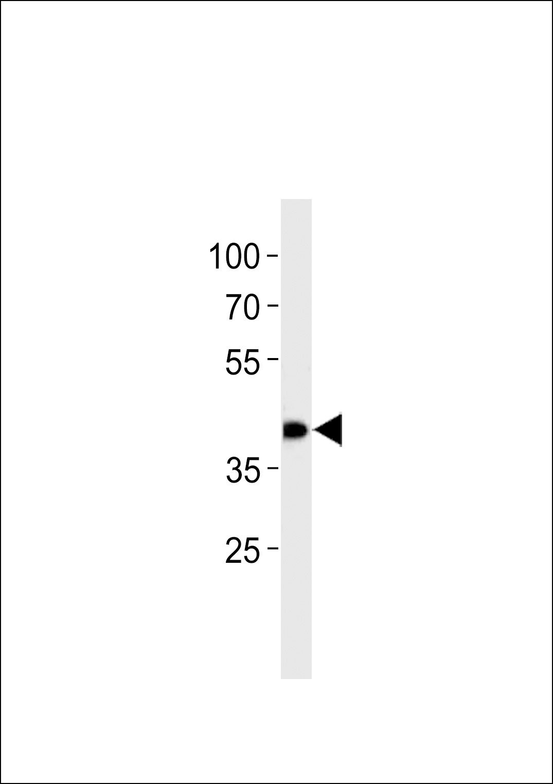 SLC2A4RG Antibody