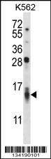 CCL15 Antibody