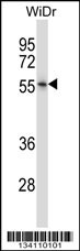 NR2E3 Antibody