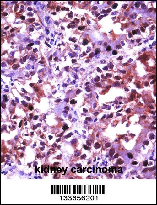 HSF1 Antibody