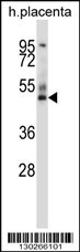 GRAMD3 Antibody