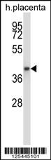 GNAQ Antibody