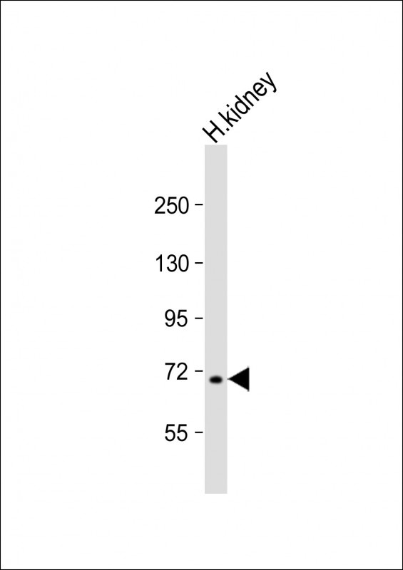 KMT2E Antibody