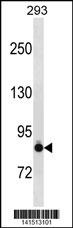CDH6 Antibody