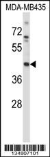 Mouse Map2k1 Antibody