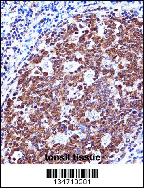 ZAP70 Antibody