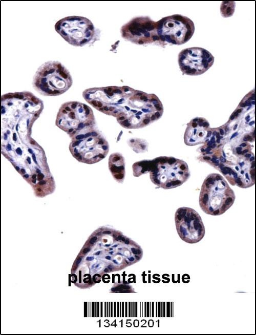 SOCS6 Antibody