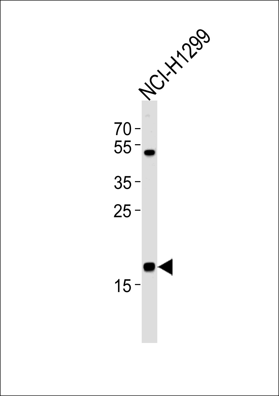 CFL2 Antibody