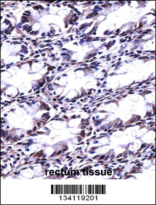 CFL2 Antibody
