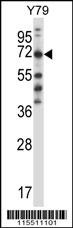 FARSB Antibody