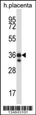 Stk26 Antibody